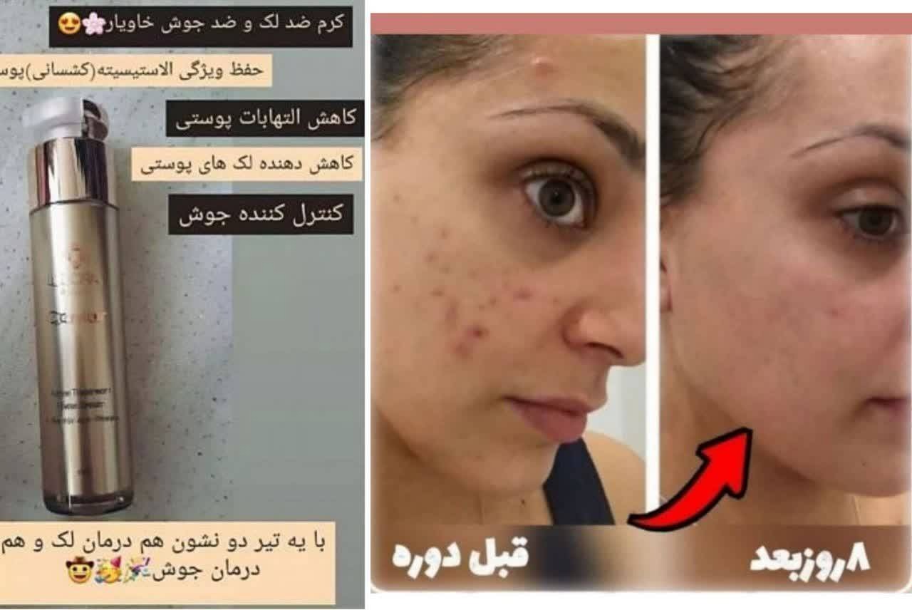 محصولات لدورا