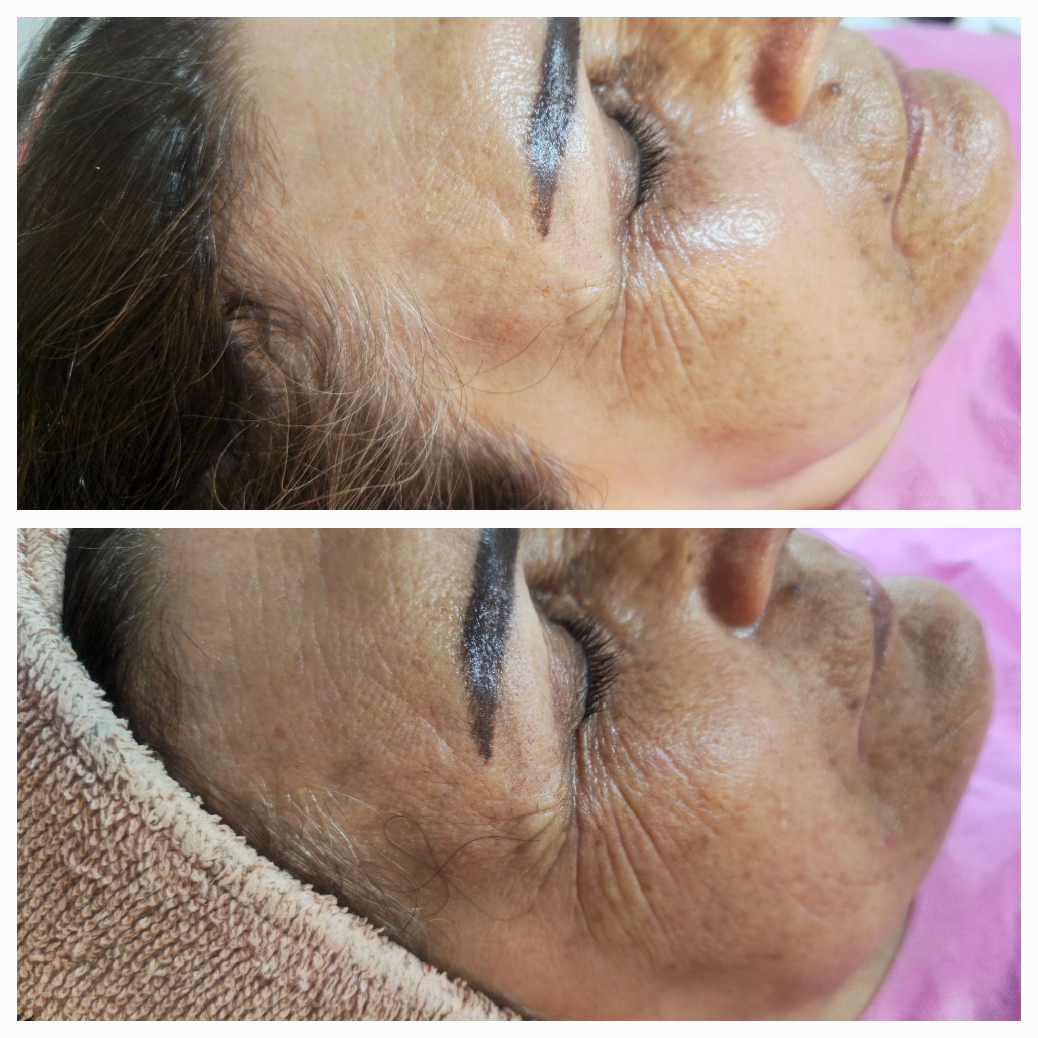 خدمات پاکسازی پوست کامرانی