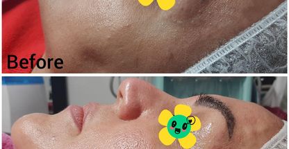 فیشیال روناک