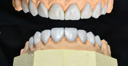 پروتزیست دندان لابراتوار پروتز دندان