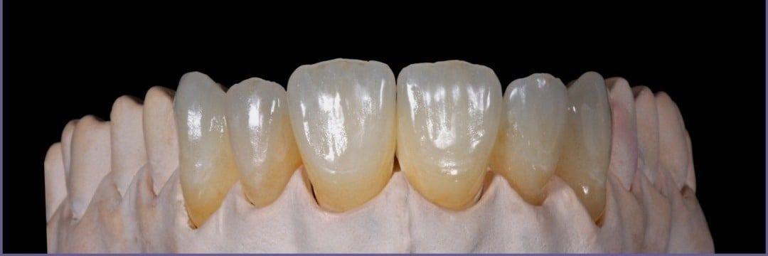 دندان سازی لبخند