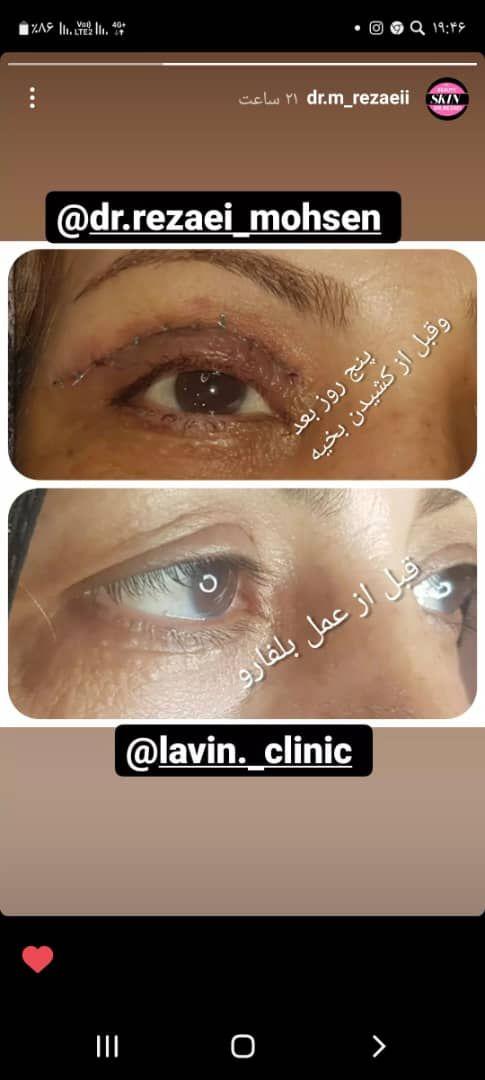 کلینیک پوست، مو و زیبایی لاوین