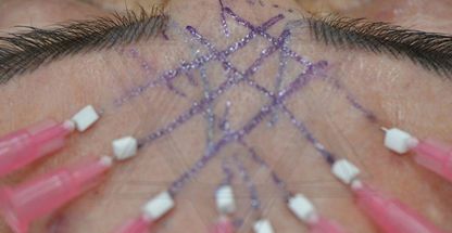 تکنسین پوست و مو