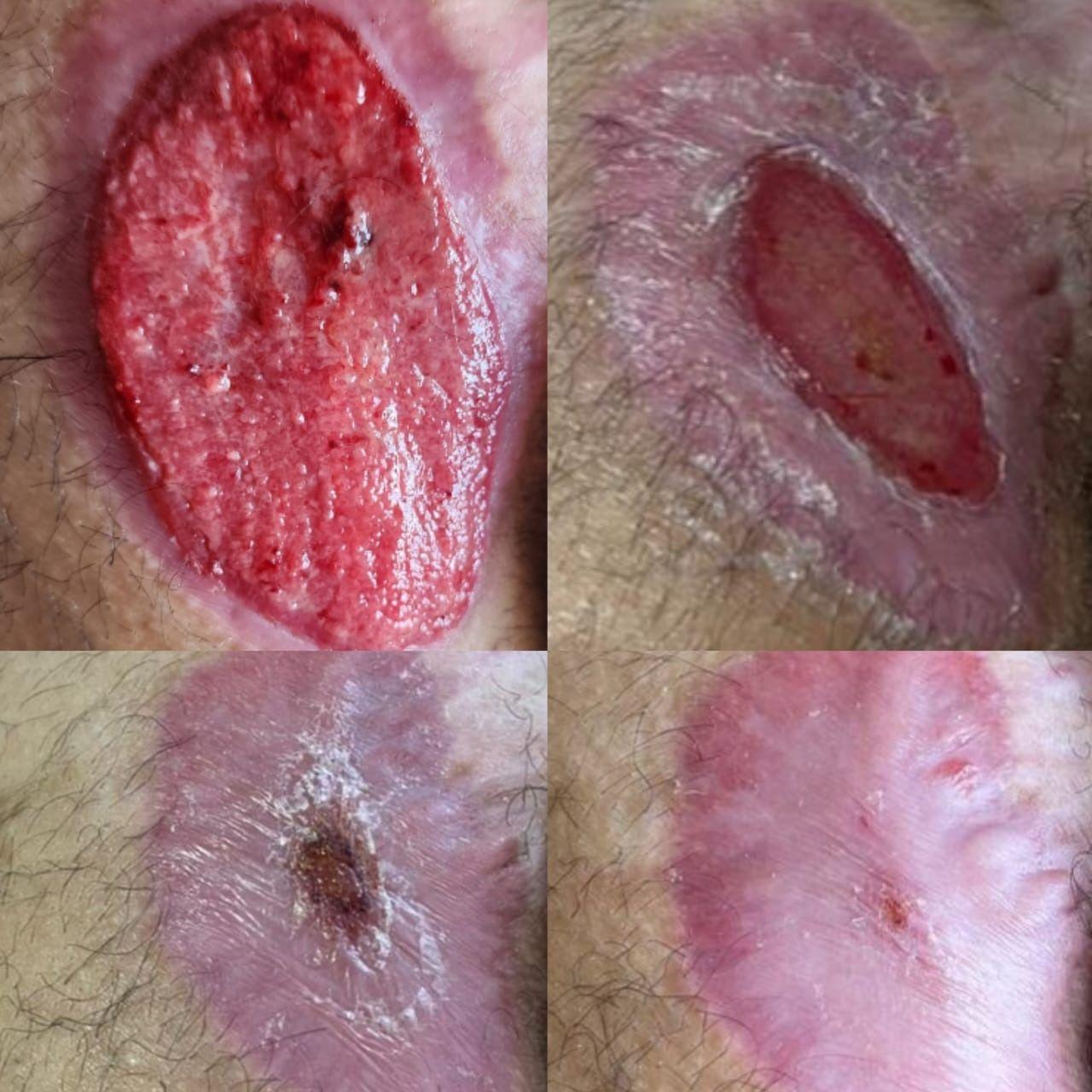 مرکز خدمات پرستاری درمانی یاسین زخم بستر