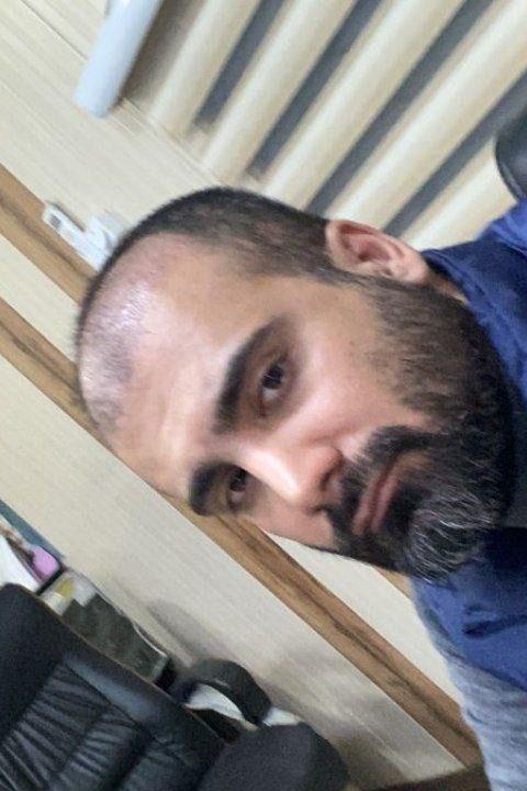 کلینیک کاشت مو و ابرو آذرنوش