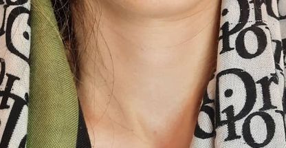 مطب پوست ومو و زیبایی  دکتر عاطفه بیرامی