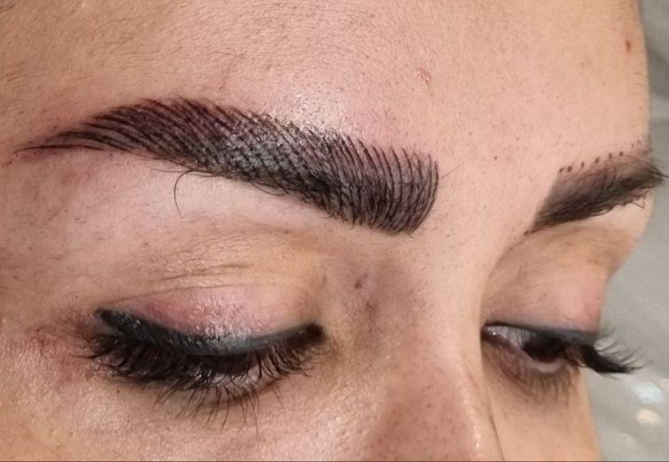 میکروبلیدینگ و میکروپیگمنتیشن