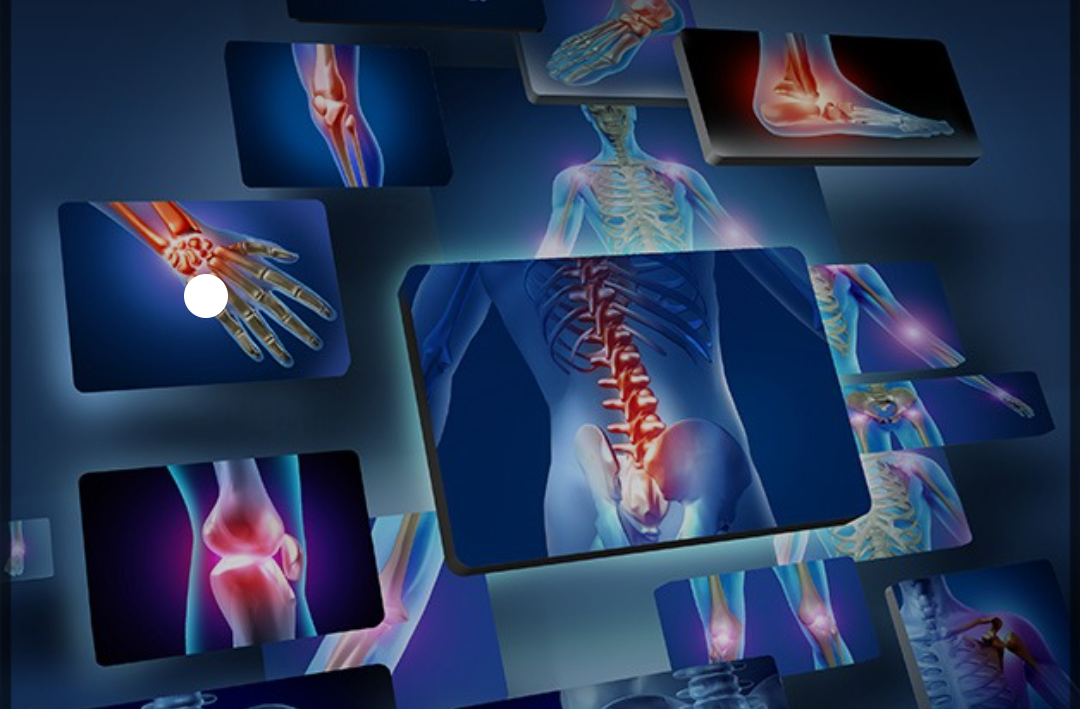 شکسته بندی و درمان دستی محسن