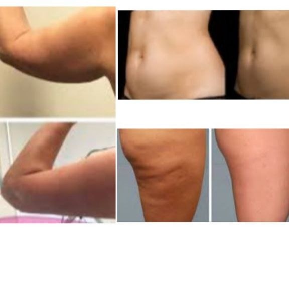 بهترین کلینیک زیبایی فلاح هایفو سودا