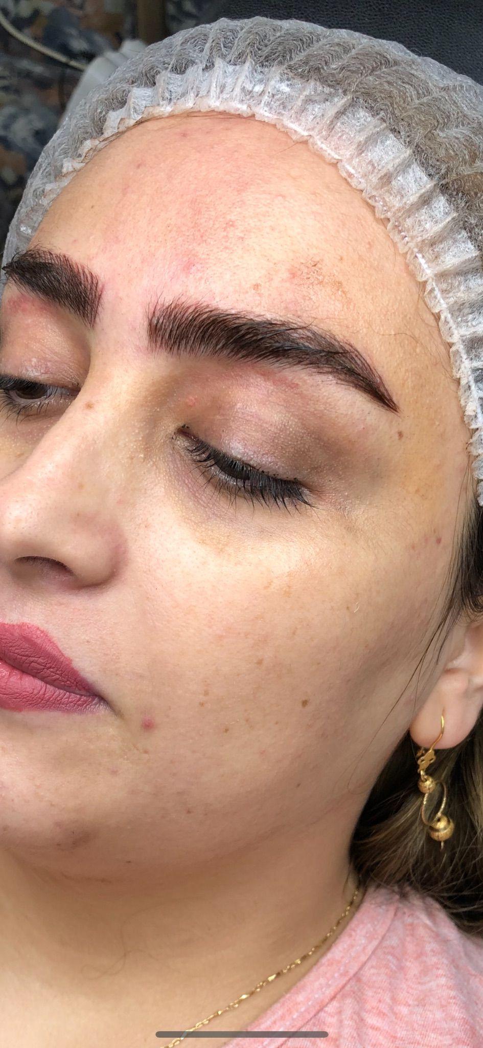 میکروبلیدینگ و میکروپیگمنتیشن سوگند