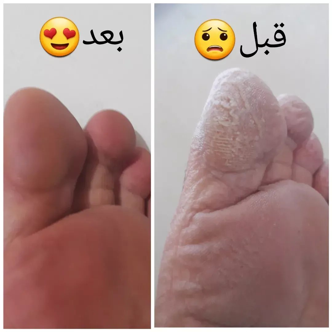 پدیکور خانم و آقا