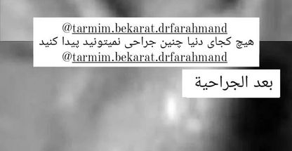 فوق متخصص جراحی های زیبایی زنان و ترمیم بکارت در تهران و تبریز