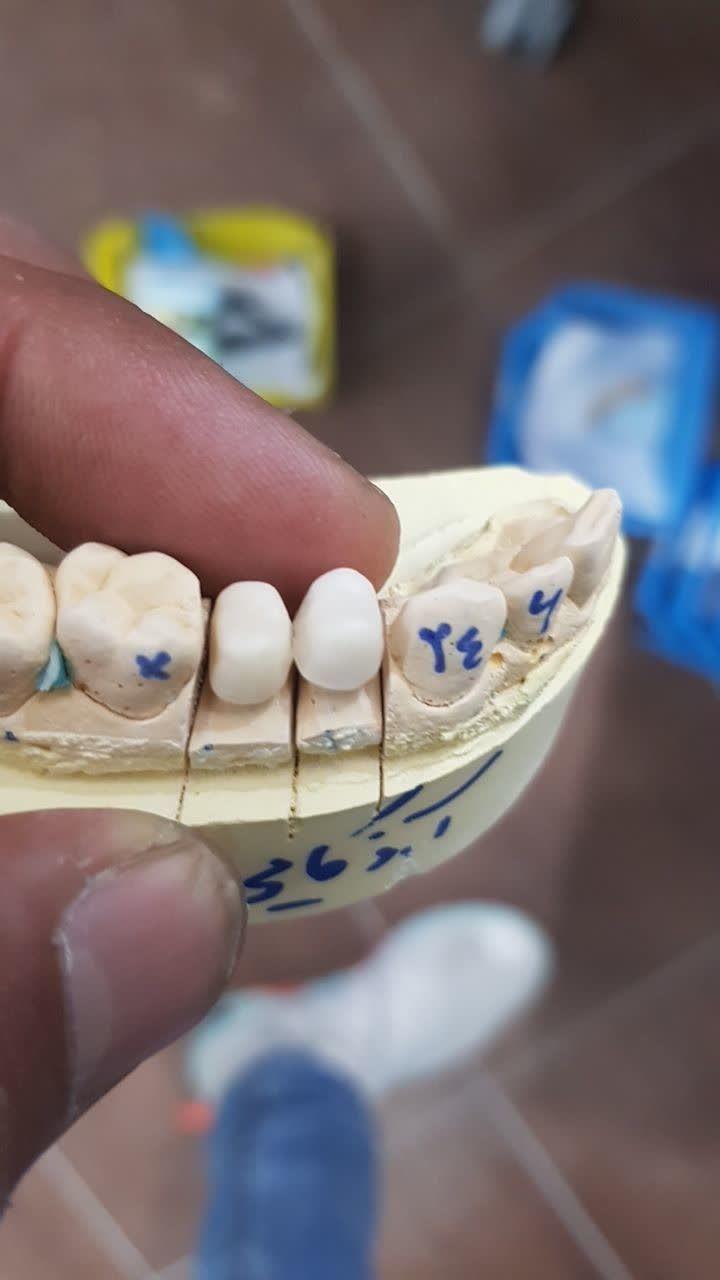 فروش دستگاه و مواد دندان سازی معین
