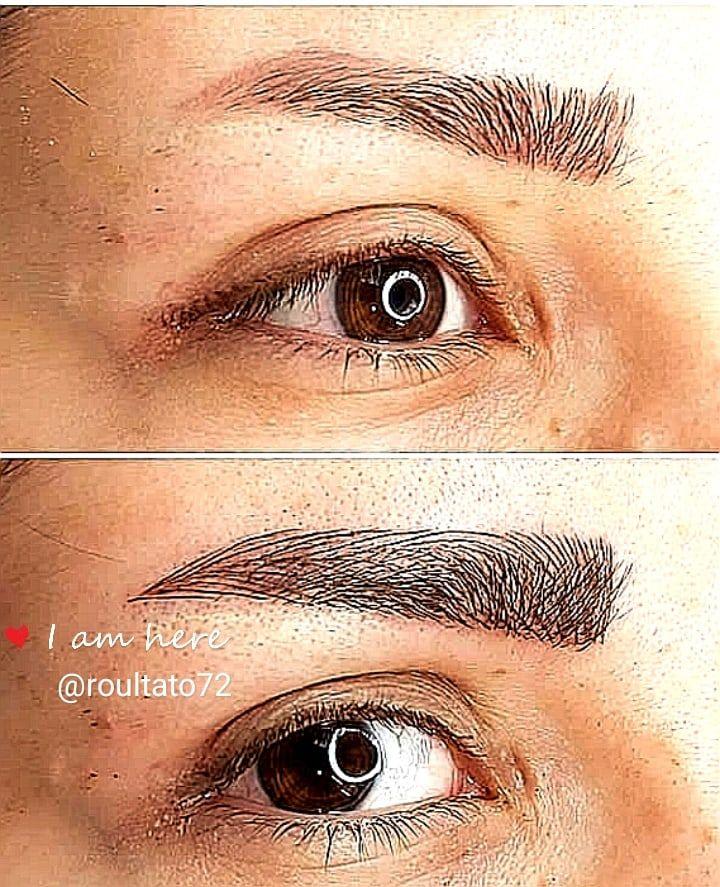 فیبروز میکروبلیدینگ و خدمات تاتو ابرا