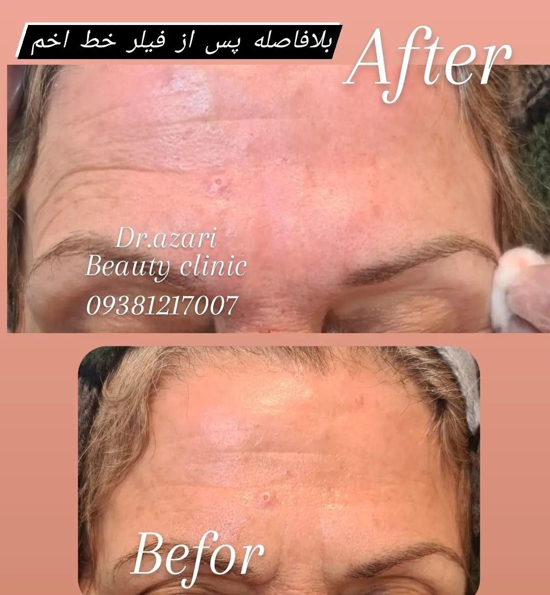 کلینیک پوست مو و زیبایی دکتر آذری