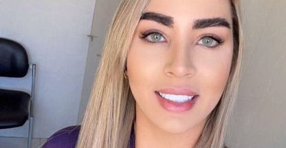 کاشت ابرو .مو هیر افراا