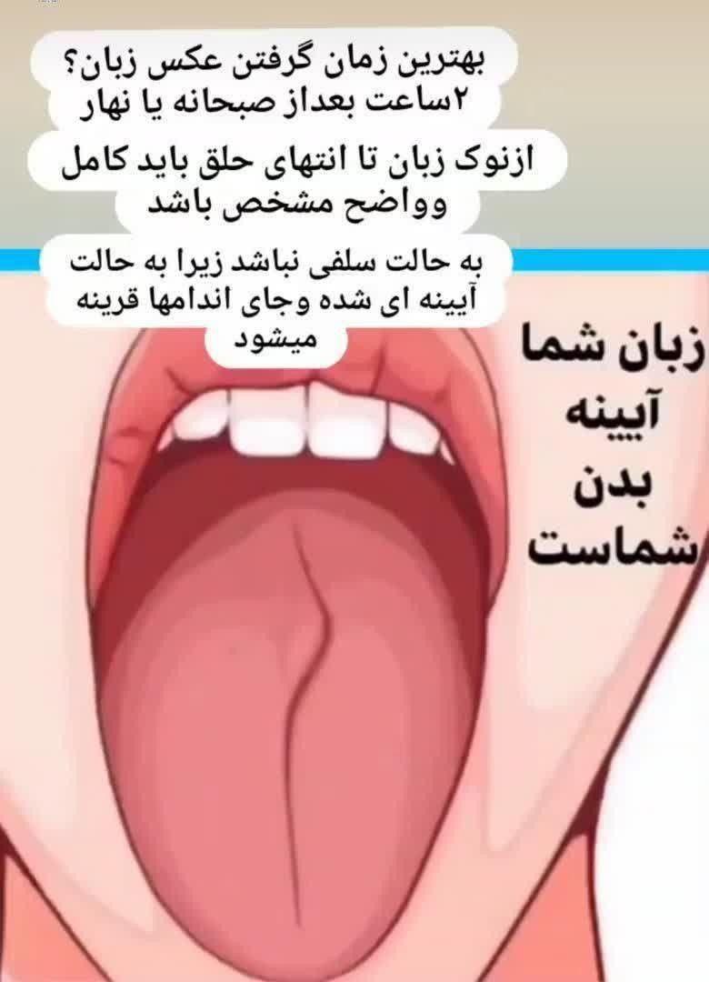 سنوگرافی بدن از روی عکس زبان