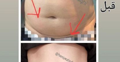 کلینیک تغذیه و رژیم درمانی امگا