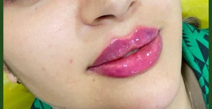 مطب دکتر زیبایی غرب