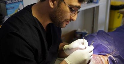 درمان زخم نادری