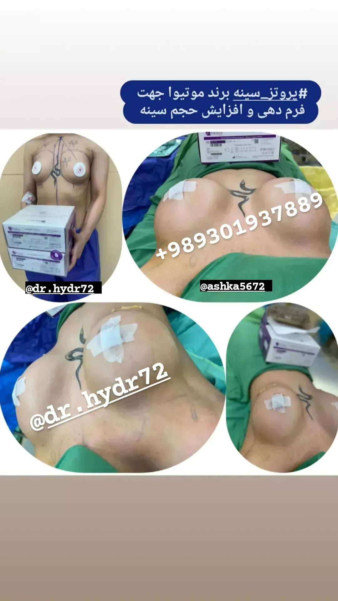 فروش تجهیزات پزشکی و پروتز