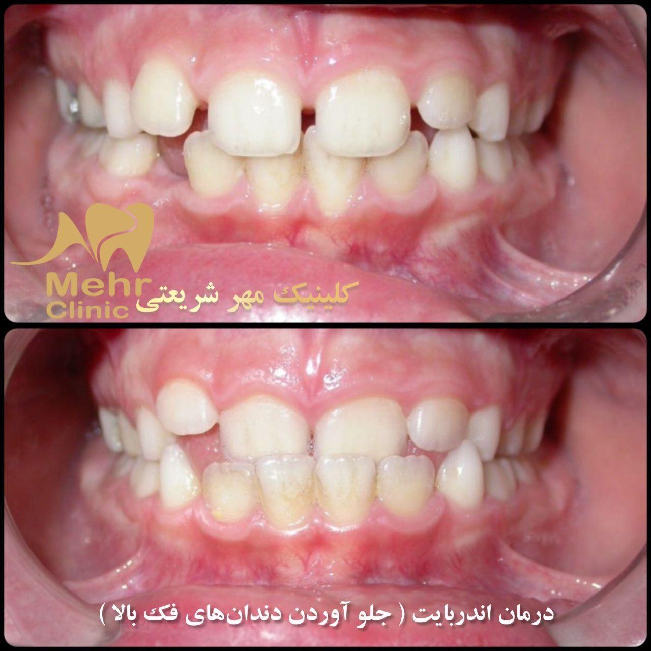 کلینیک دندانپزشکی مهر شریعتی