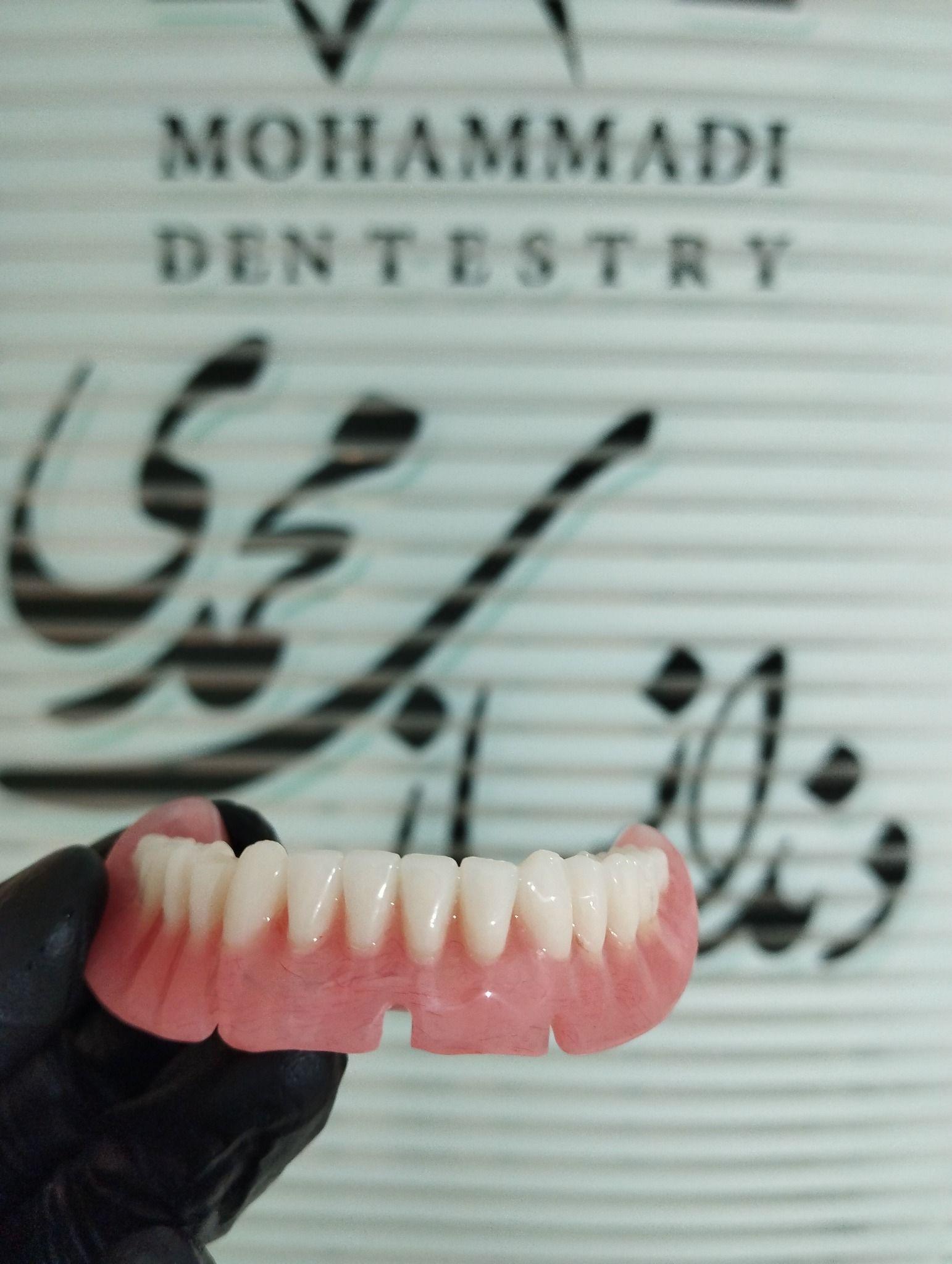 دندانسازی محمدی