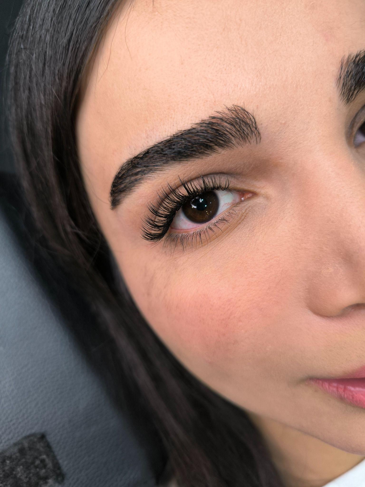 کاشت مژه مونلَش (Moonlash)