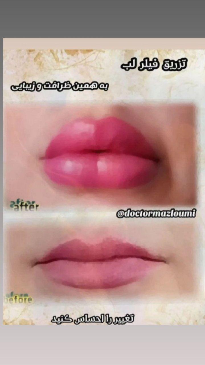 متخصص زیبایی دکتر سید حسن مظلومی