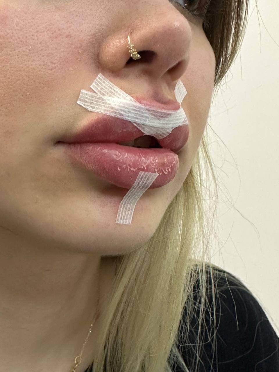 کلینیک زیبایی و لیزر نشمیل،