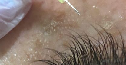 کلینیک زیبایی الیزه