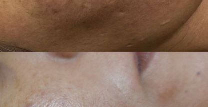 پاکسازی پوست سپیده گلشنی