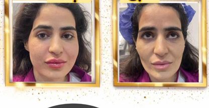 کلینیک پوست مو زیبایی آنید