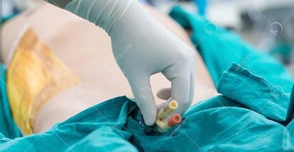 خدمات پرستاری بابلسر بهنمیر امیرکلا