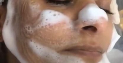 پاکسازی و فیشیال درمانی فروزان