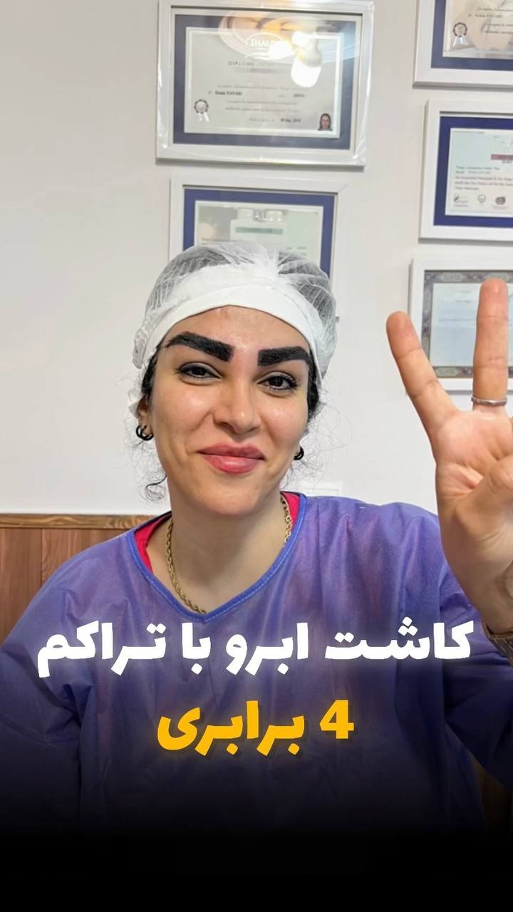 کلینیک تخصصی پوست و مو کاشت ابرو حسینی