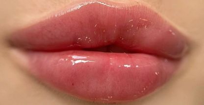 مطب زیبایی دکتر جهاندیده