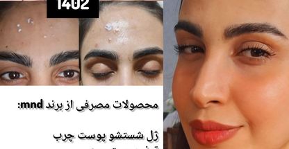 مشاوره پوست و مو زیبایی