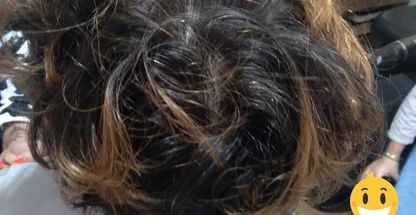 مشاور پوست پاک سازی رشک وشپش شهلا