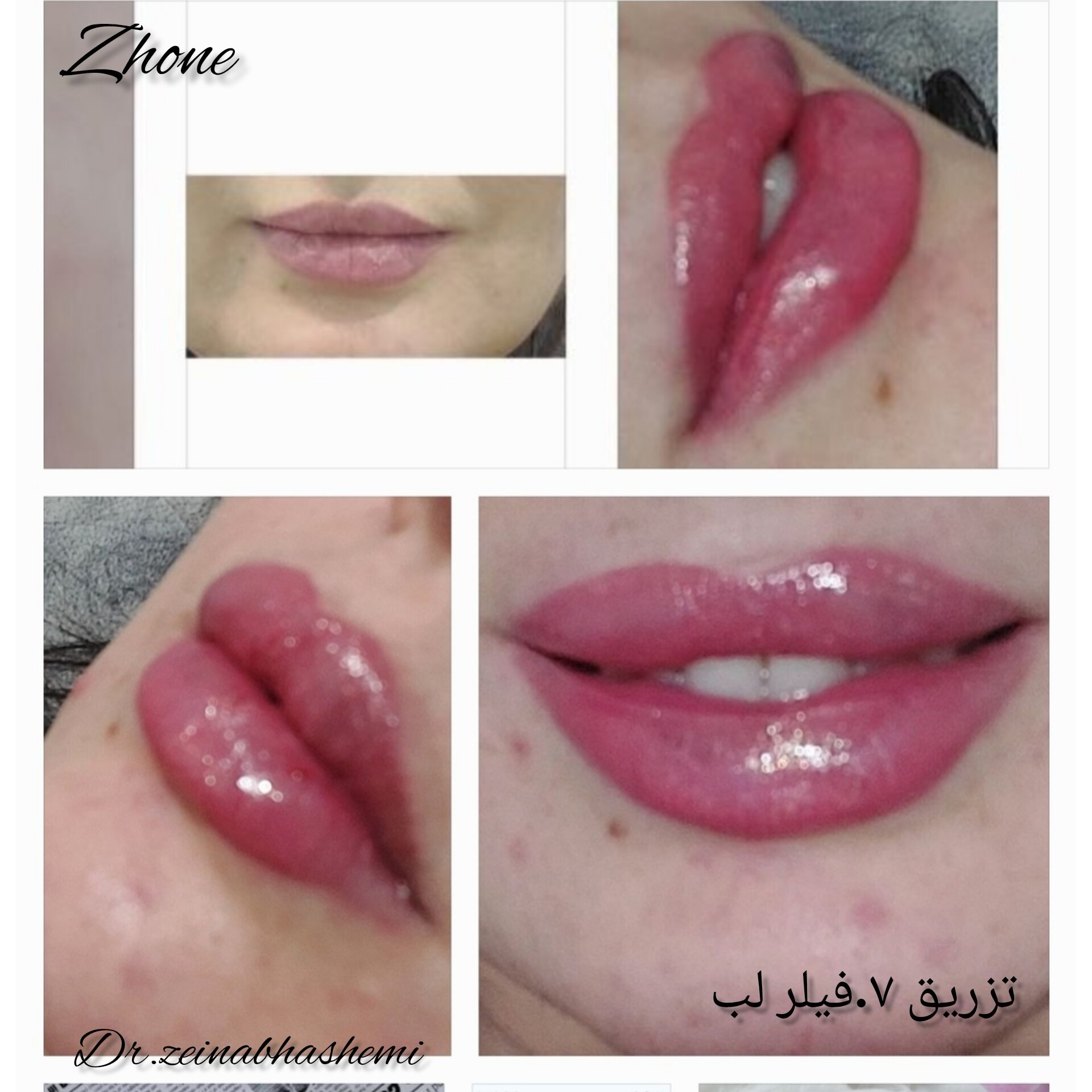 مطب زیبایی zh one دکتر زینب هاشمی