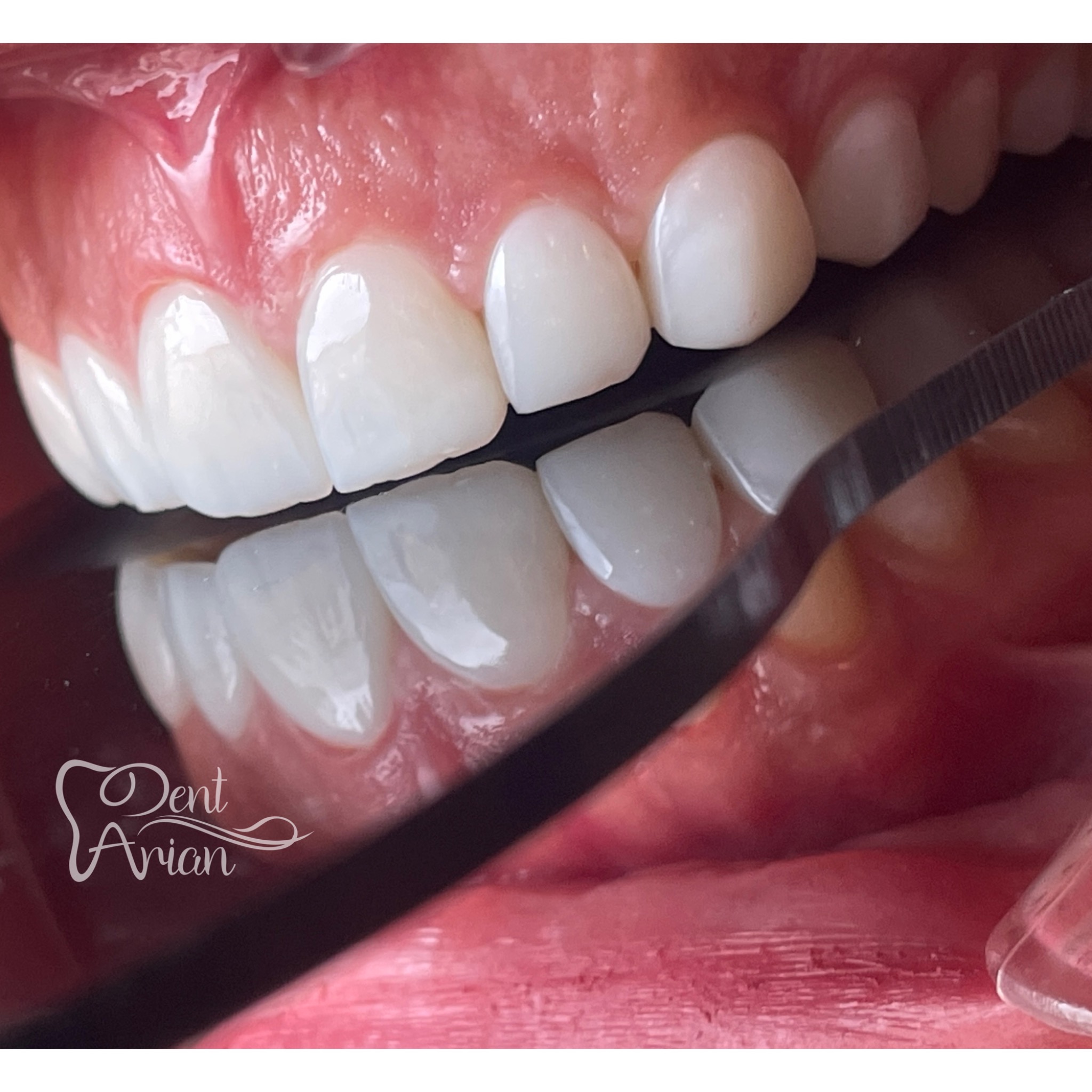 مركز دندانپزشكى دنت آرين