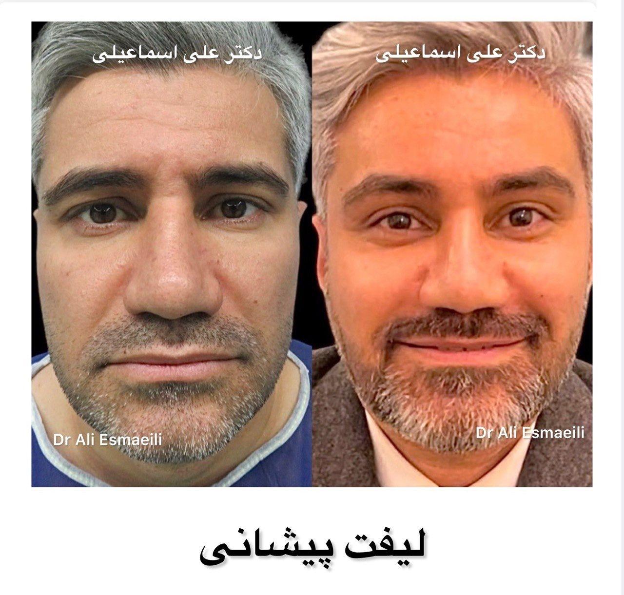 دکتر علی اسماعیلی جراح پلاستیک و زیبایی