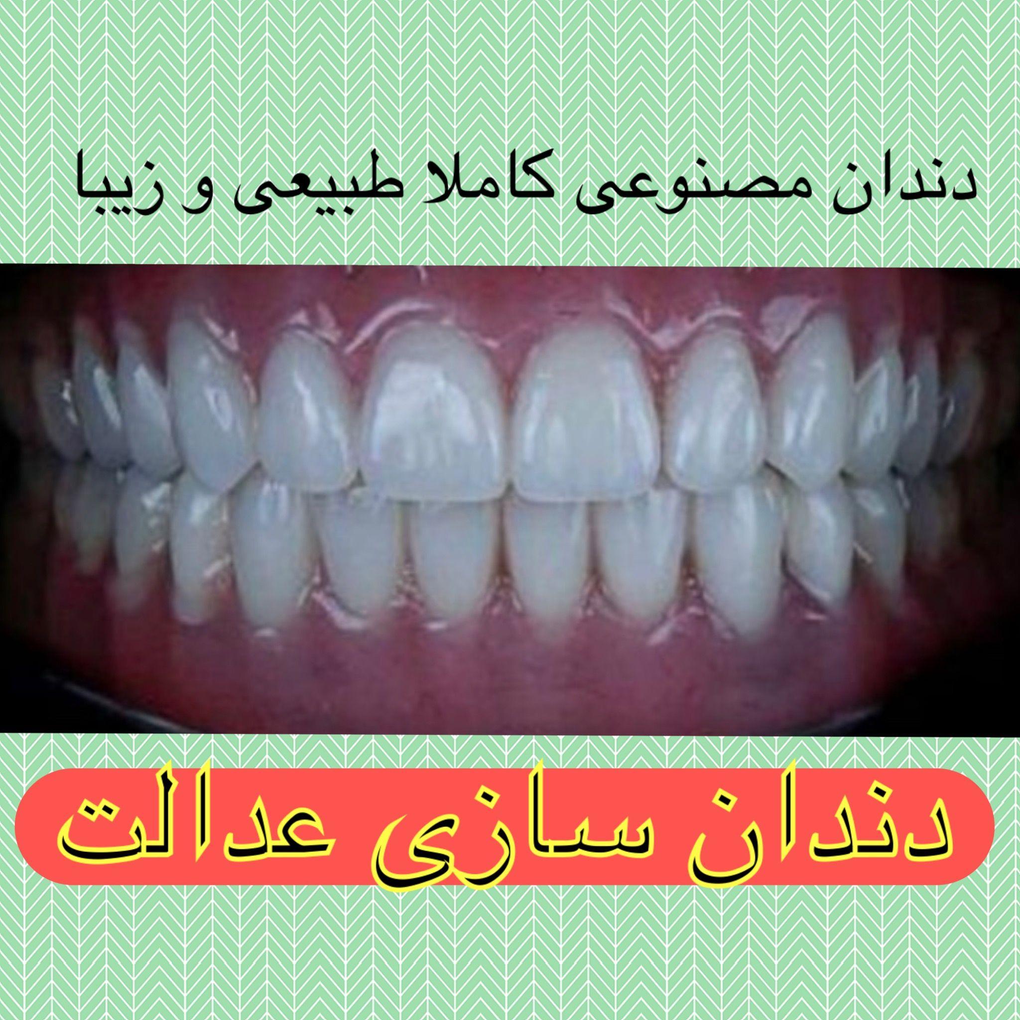 ساخت دندان مصنوعى