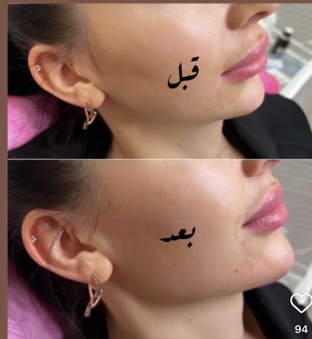 كلينيک پوست، مو و زیبایی ليليان