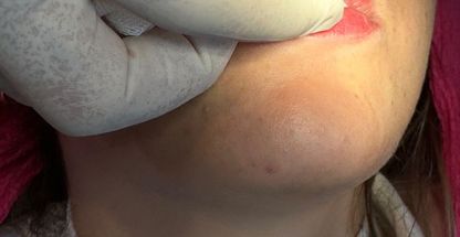 کلینیک کاشت مو و کلینیک زیبایی دکتر ادبی