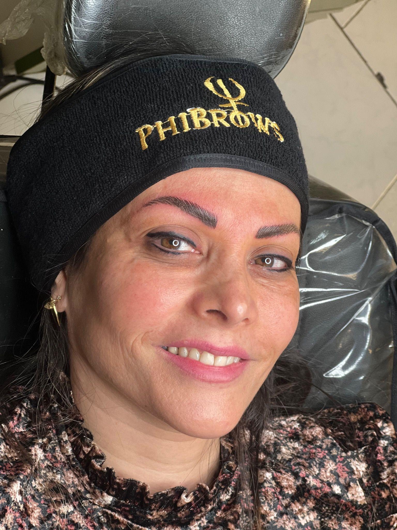 میکروبلیدینگ و میکروپیگمنتیشن سونیا