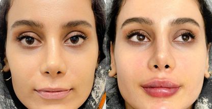 مطب پوست مو و لیزر دکتر مریم ضیایی