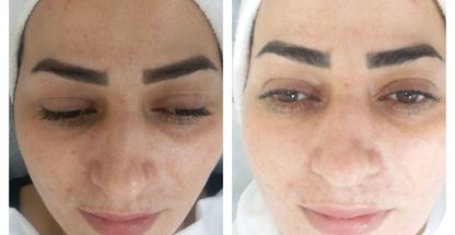 آموزش و خدمات فیشیال تخصصی