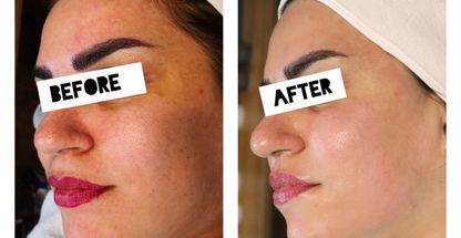 مرکز فیشیال و پاکسازی پوست پارلا