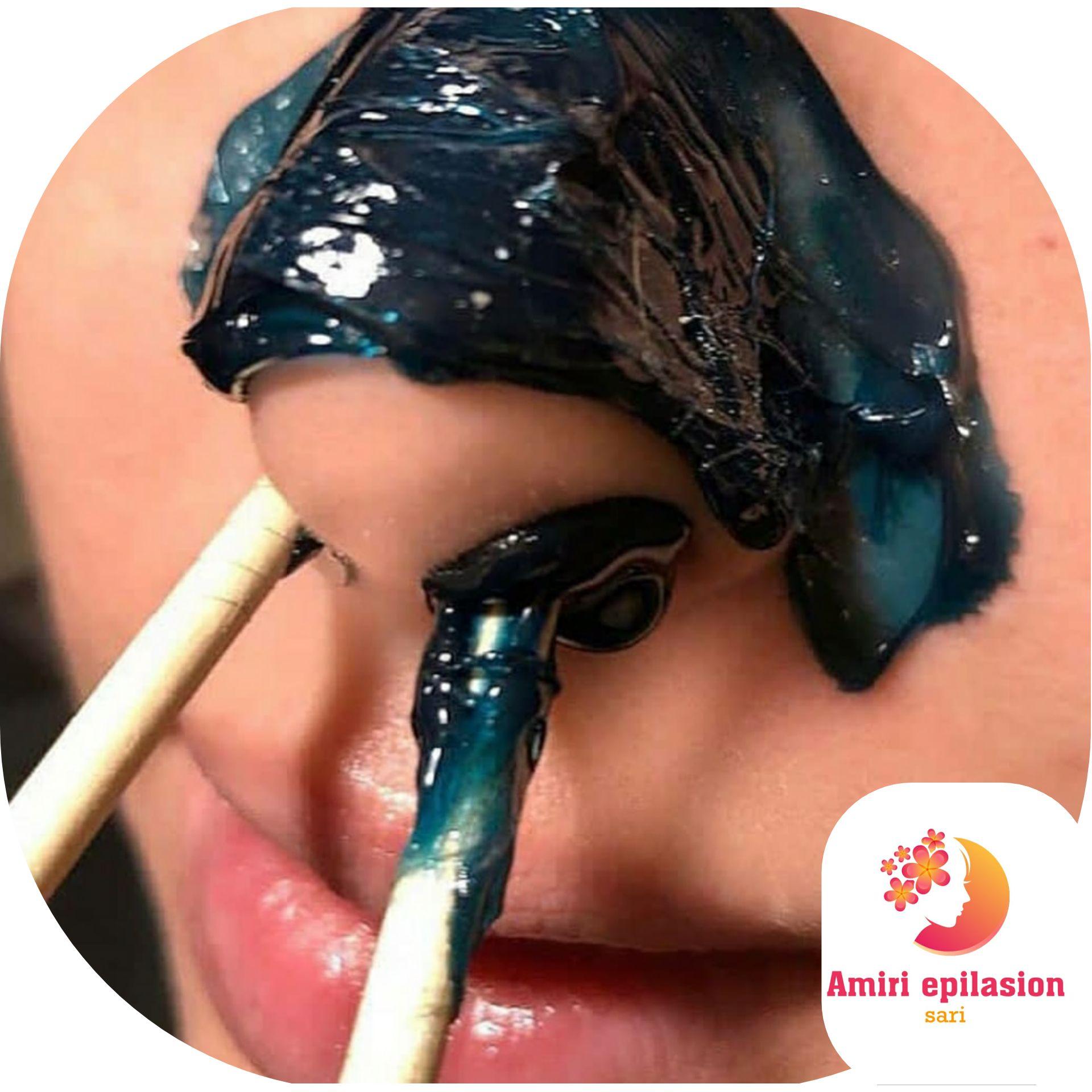 اپیلاسیون تخصصی بدن بانوان در ساری